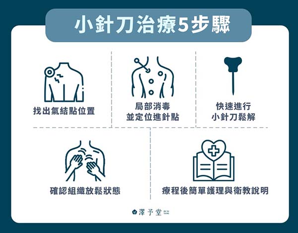 小針刀治療5步驟