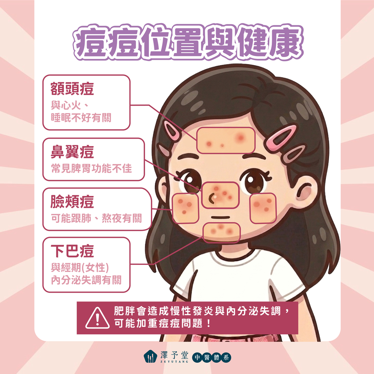 痘痘體質,中醫調理痘痘,長痘痘原因,肺熱型痘痘,肝鬱型痘痘,胃火型痘痘,脾濕型痘痘,抗痘飲食